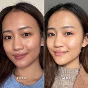 🆕️✨️Alpha-H Liquid Gold with Glycolic Acid